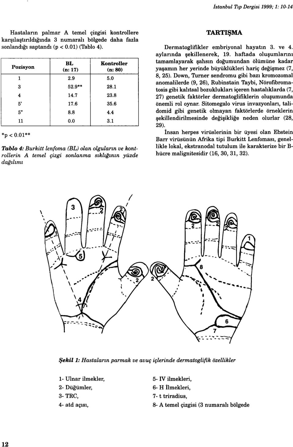 1 Tablo 4: Burkitt lenfoma () olan olguların ve kontrollerin A temel çizgi sonianma sıklığının yüzde dağılımı TARTIŞMA Dermatoglifikler embriyonal hayatın 3. ve 4. aylannda şekillenerek, 19.