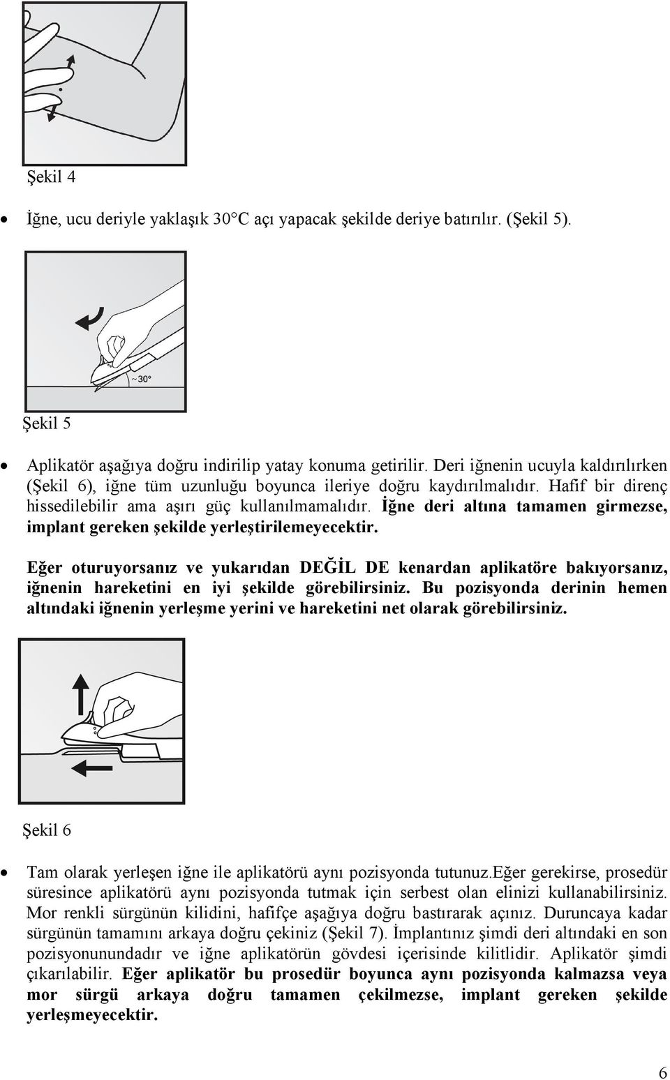 İğne deri altına tamamen girmezse, implant gereken şekilde yerleştirilemeyecektir.