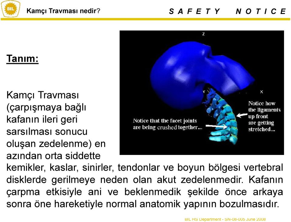 zedelenme) en azından orta şiddette kemikler, kaslar, sinirler, tendonlar ve boyun bölgesi