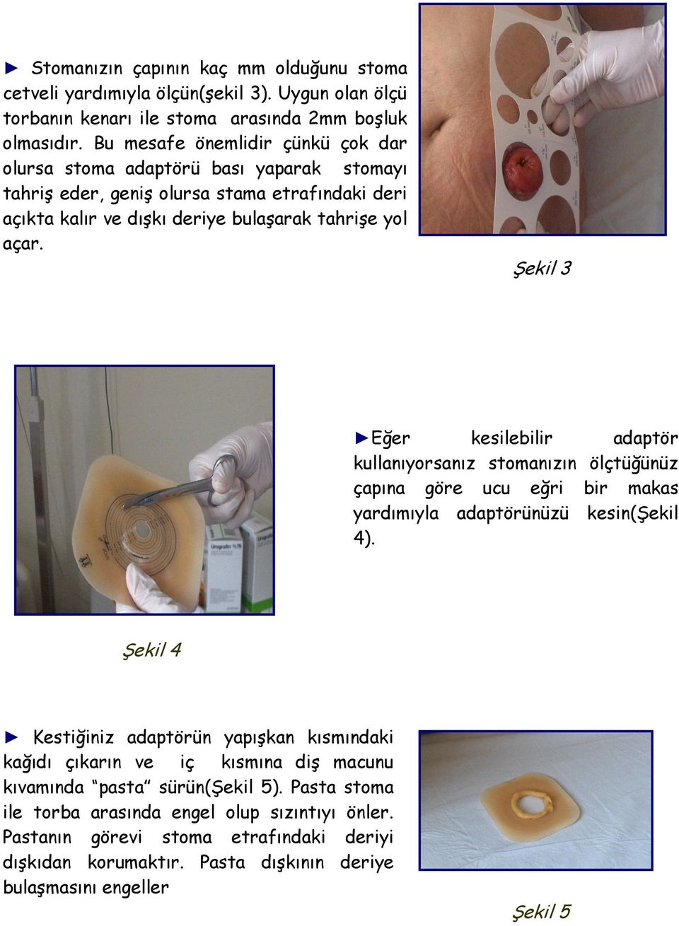 Şekil 3 Eğer kesilebilir adaptör kullanıyorsanız stomanızın ölçtüğünüz çapına göre ucu eğri bir makas yardımıyla adaptörünüzü kesin(şekil 4).