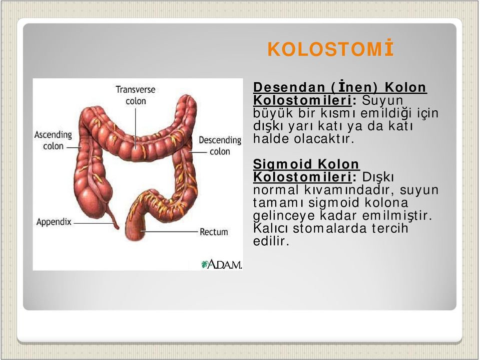 Sigmoid Kolon Kolostomileri: normal k vam ndad r, suyun tamam