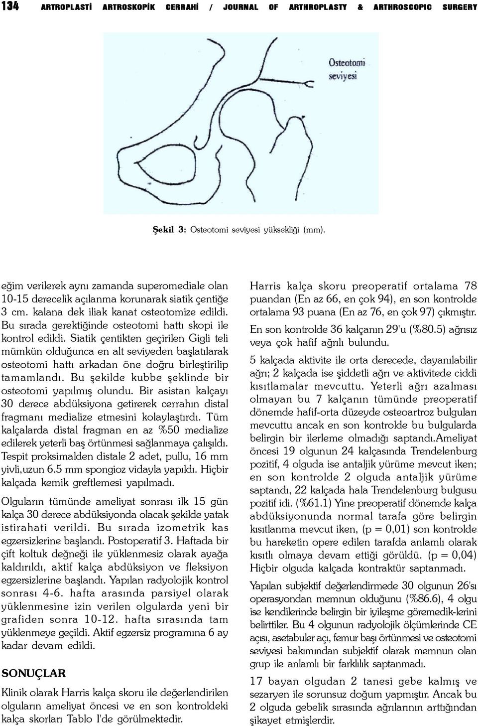 Bu sýrada gerektiðinde osteotomi hattý skopi ile kontrol edildi.