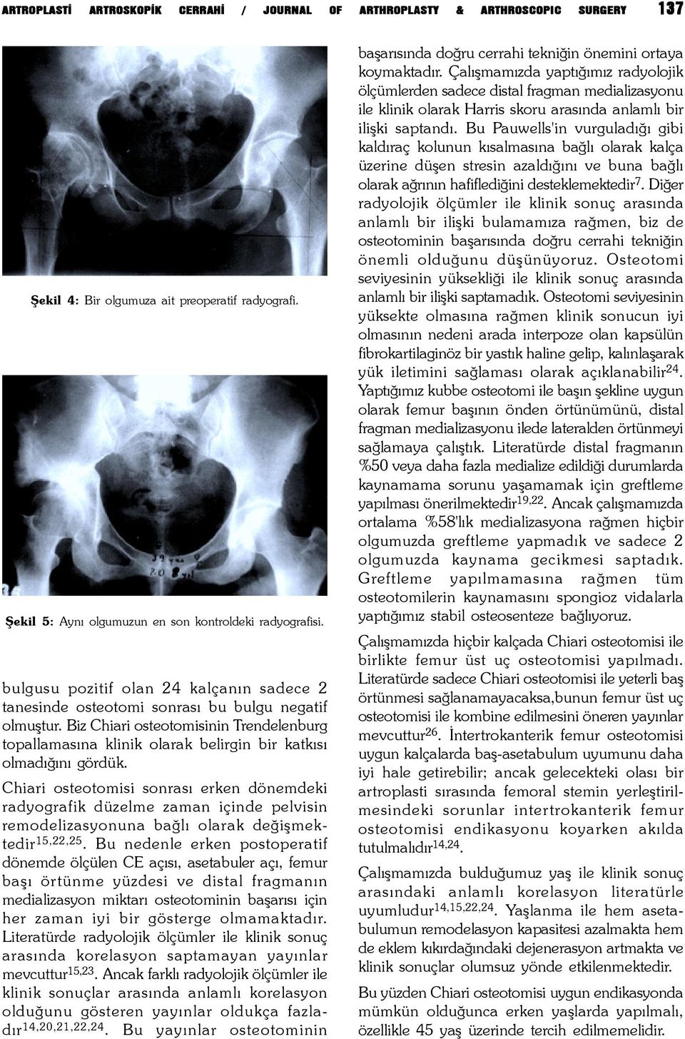 Biz Chiari osteotomisinin Trendelenburg topallamasýna klinik olarak belirgin bir katkýsý olmadýðýný gördük.