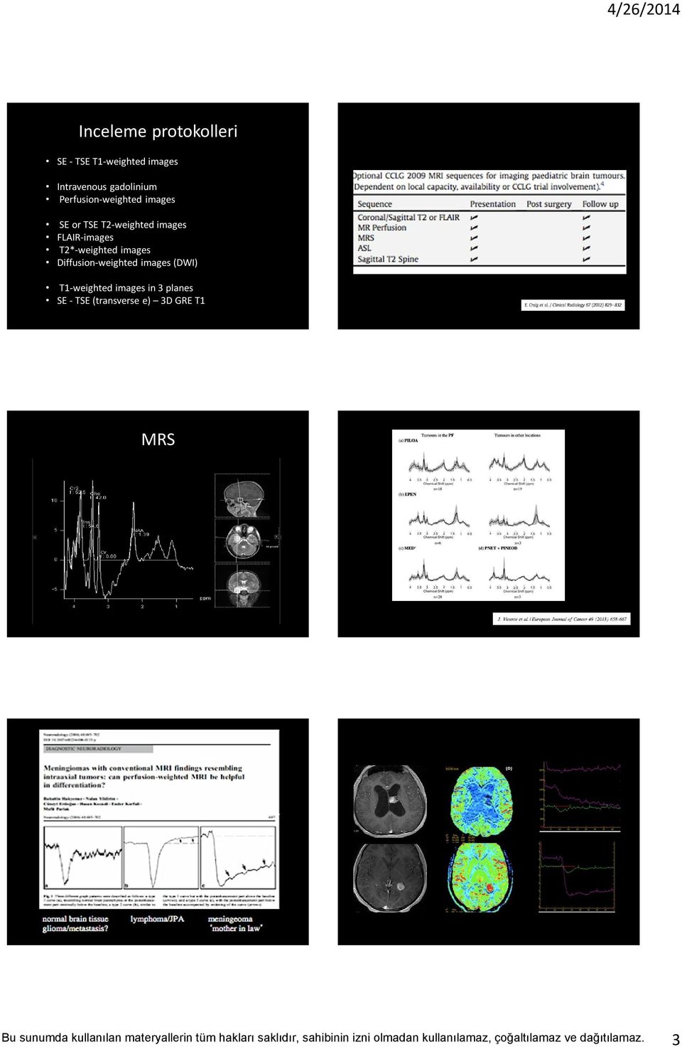 FLAIR-images T2*-weighted images Diffusion-weighted images (DWI)