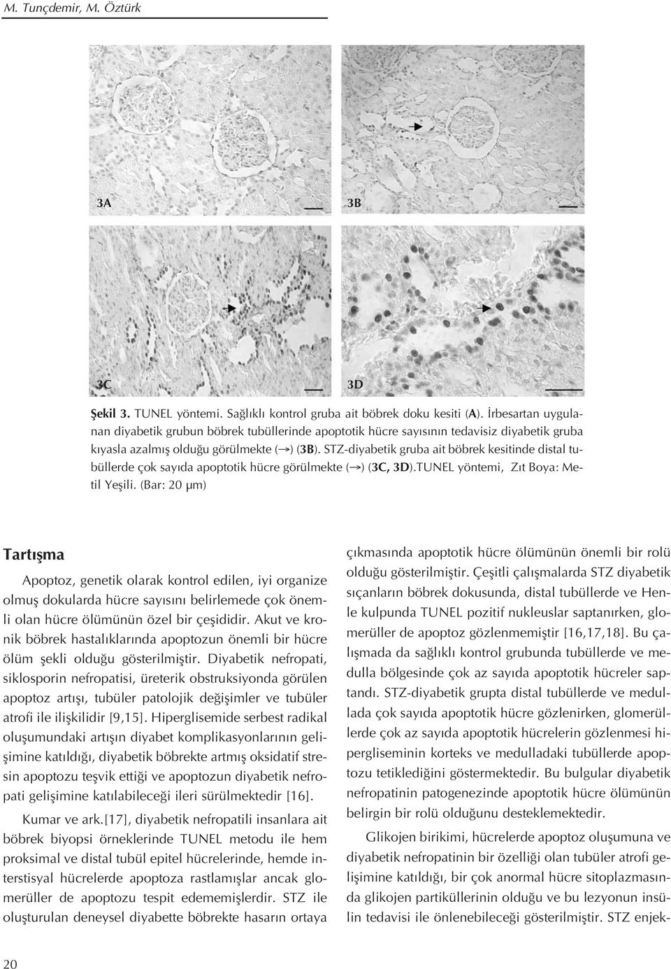 STZ-diyabetik gruba ait böbrek kesitinde distal tubüllerde çok say da apoptotik hücre görülmekte ( ) (3C, 3D).TUNEL yöntemi, Z t Boya: Metil Yeflili.