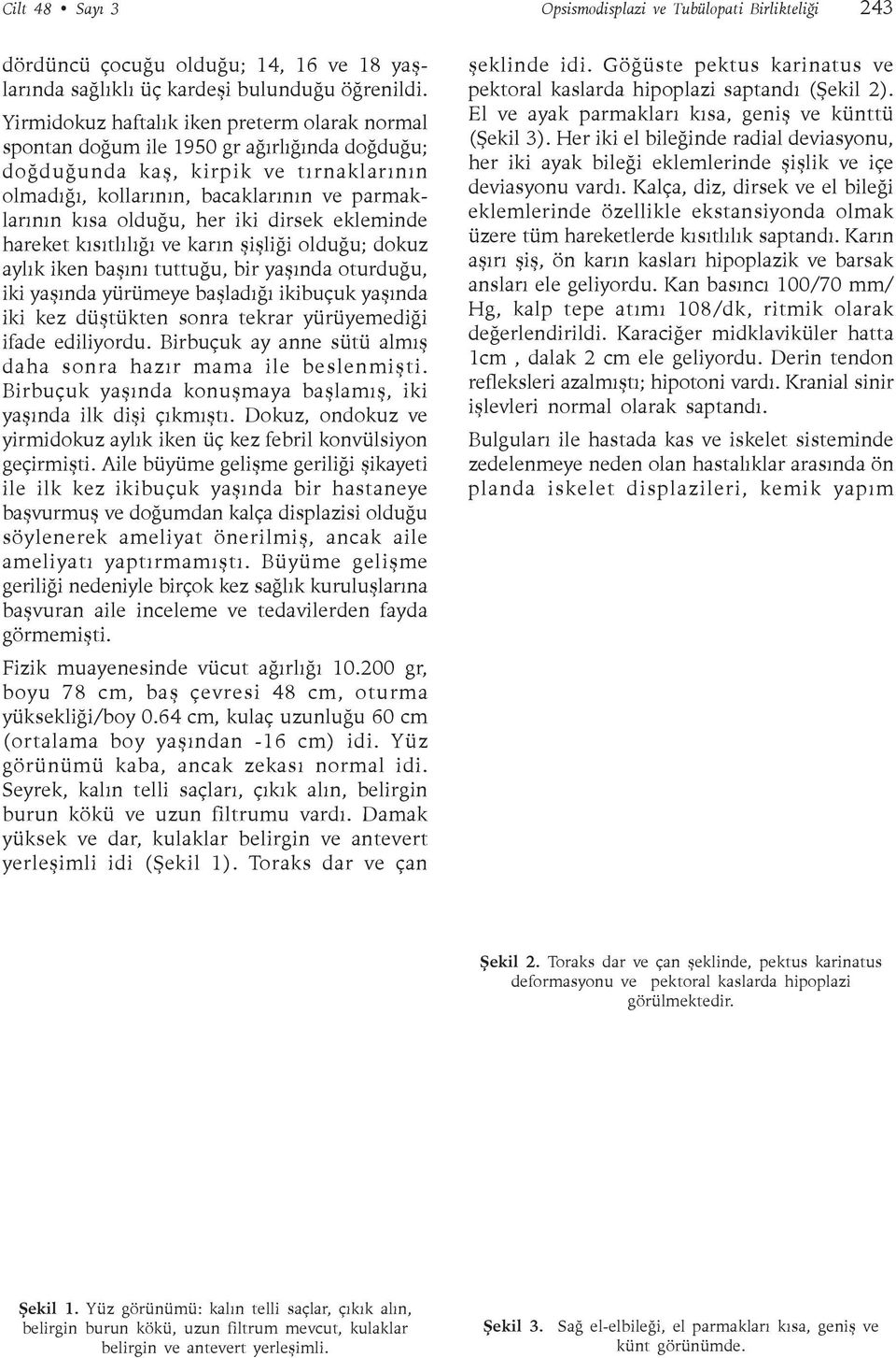 her iki dirsek ekleminde hareket kýsýtlýlýðý ve karýn þiþliði olduðu; dokuz aylýk iken baþýný tuttuðu, bir yaþýnda oturduðu, iki yaþýnda yürümeye baþladýðý ikibuçuk yaþýnda iki kez düþtükten sonra