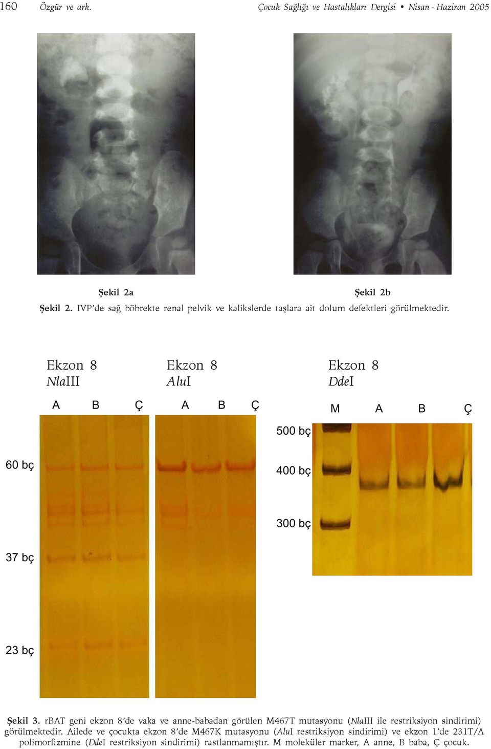 Ekzon 8 NlaIII Ekzon 8 AluI Ekzon 8 DdeI A B Ç A B Ç M A B Ç 500 bç 60 bç 400 bç 300 bç 37 bç 23 bç Þekil 3.