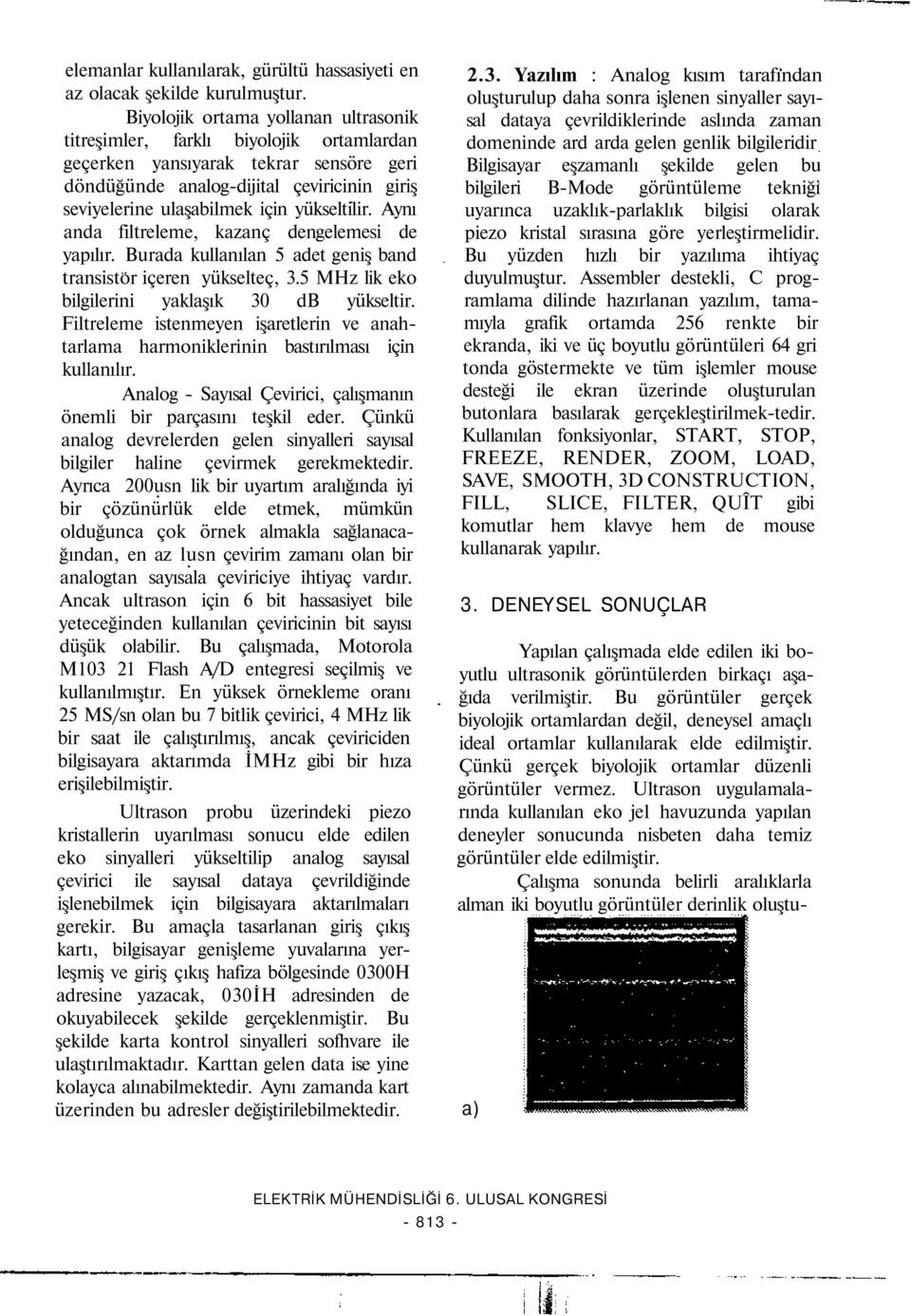 yükseltilir. Aynı anda filtreleme, kazanç dengelemesi de yapılır. Burada kullanılan 5 adet geniş band transistor içeren yükselteç, 3.5 MHz lik eko bilgilerini yaklaşık 30 db yükseltir.