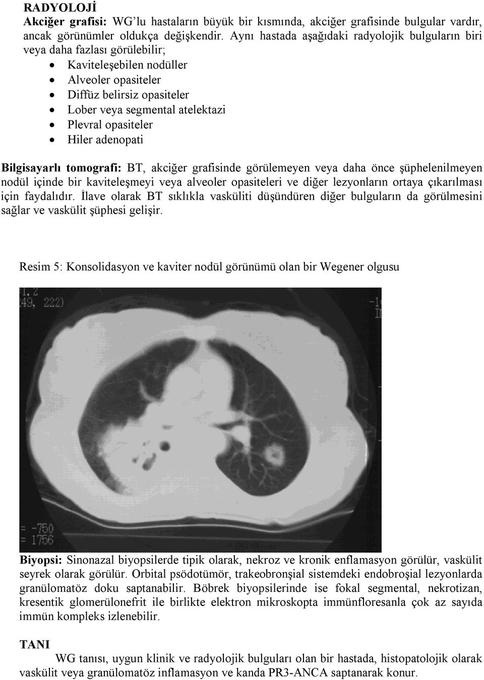 opasiteler Hiler adenopati Bilgisayarlı tomografi: BT, akciğer grafisinde görülemeyen veya daha önce şüphelenilmeyen nodül içinde bir kaviteleşmeyi veya alveoler opasiteleri ve diğer lezyonların