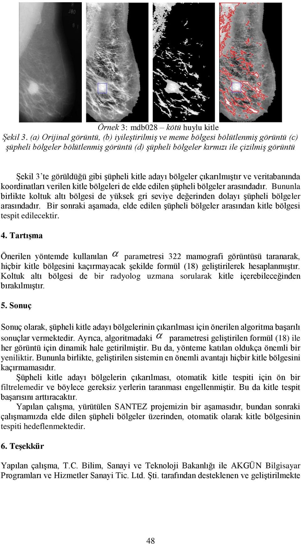 çıarılmışır ve verabanında oordnaları verlen le bölgeler de elde edlen şüphel bölgeler arasındadır. Bununla brle olu alı bölges de yüse gr sevye değernden dolayı şüphel bölgeler arasındadır.