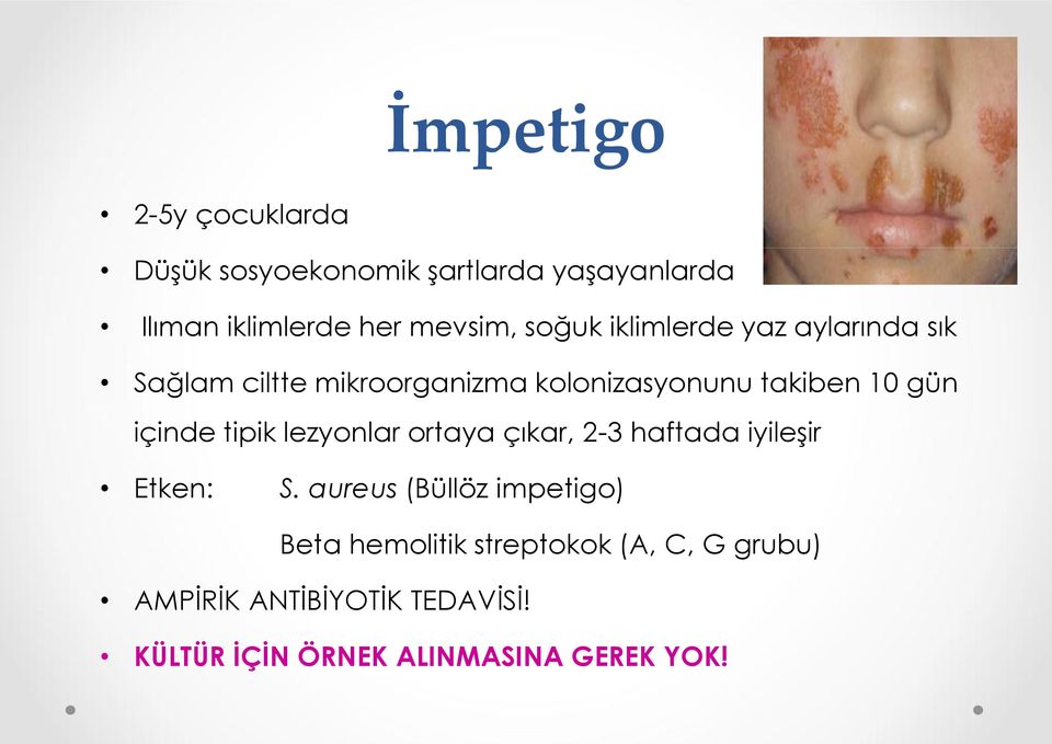 içinde tipik lezyonlar ortaya çıkar, 2-3 haftada iyileşir Etken: S.