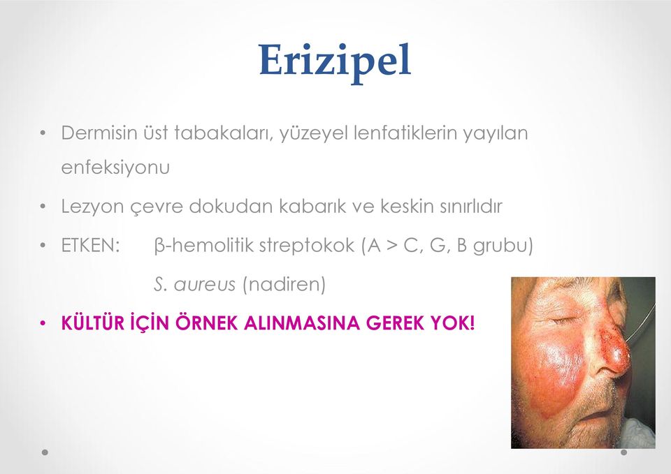 sınırlıdır ETKEN: β-hemolitik streptokok (A > C, G, B