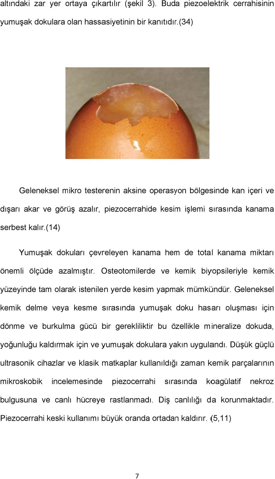 (14) Yumuşak dokuları çevreleyen kanama hem de total kanama miktarı önemli ölçüde azalmıştır.