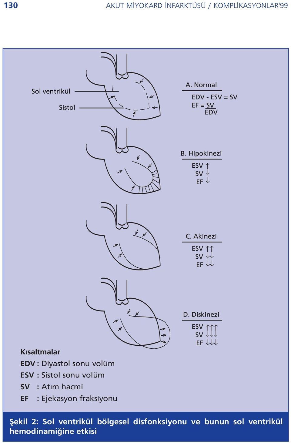 hacmi EF : Ejekasyon fraksiyonu fiekil 2: Sol ventrikül