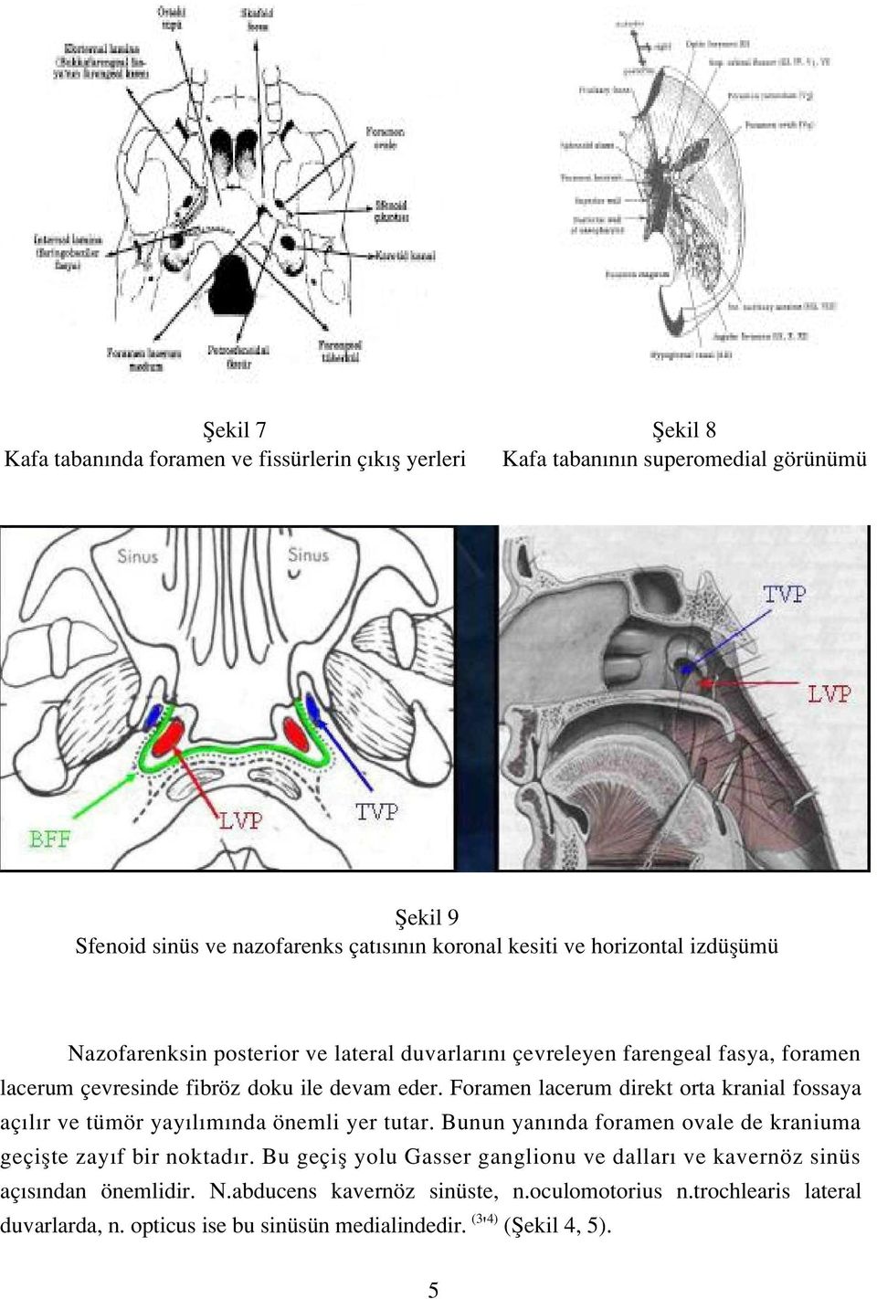 Foramen lacerum direkt orta kranial fossaya aç l r ve tümör yay l m nda önemli yer tutar. Bunun yan nda foramen ovale de kraniuma geçiflte zay f bir noktad r.