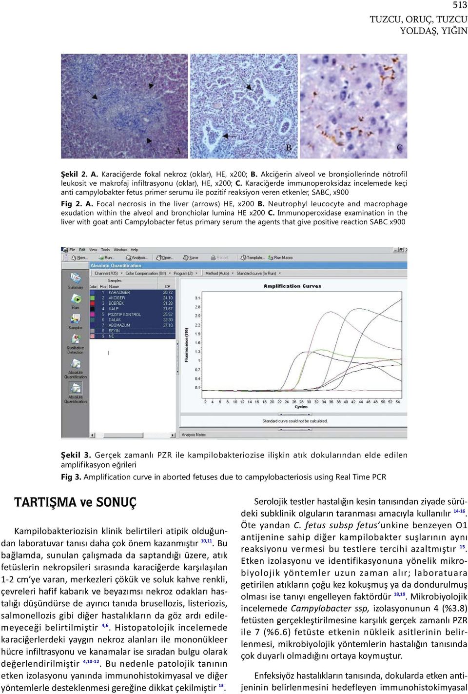 Neutrophyl leucocyte and macrophage exudation within the alveol and bronchiolar lumina HE x200 C.
