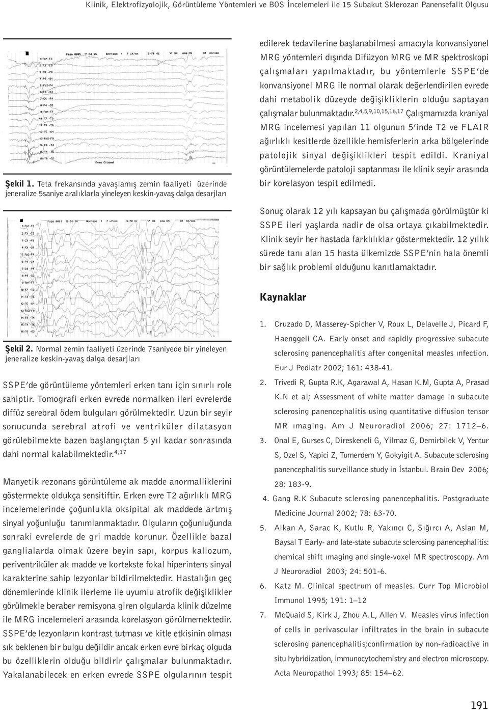 dýþýnda Difüzyon MRG ve MR spektroskopi çalýþmalarý yapýlmaktadýr, bu yöntemlerle SSPE de konvansiyonel MRG ile normal olarak deðerlendirilen evrede dahi metabolik düzeyde deðiþikliklerin olduðu