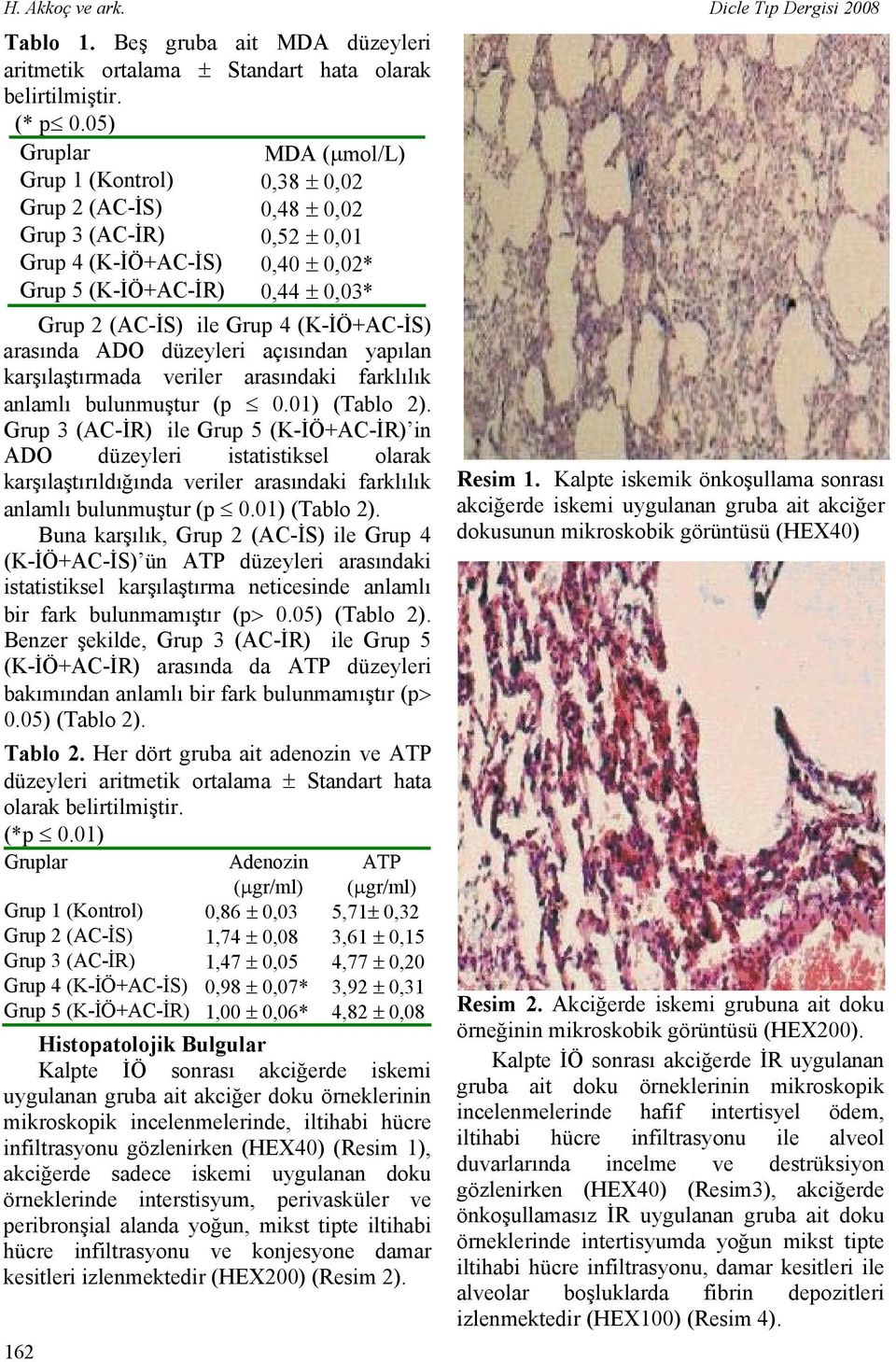 (K-İÖ+AC-İS) arasında ADO düzeyleri açısından yapılan karşılaştırmada veriler arasındaki farklılık anlamlı bulunmuştur (p 0.01) (Tablo 2).