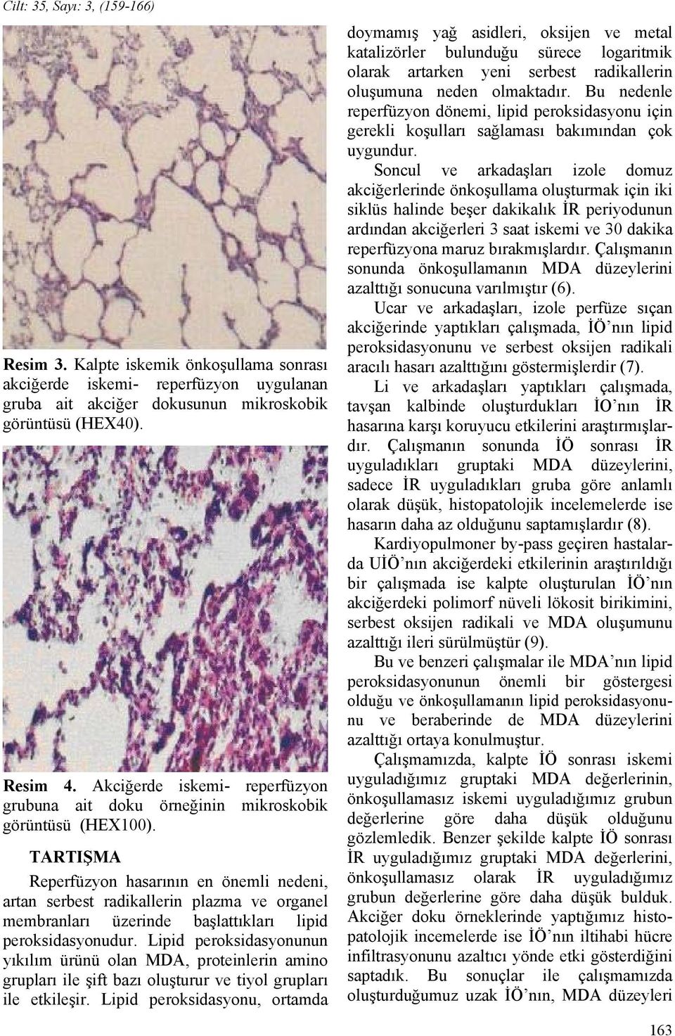 TARTIŞMA Reperfüzyon hasarının en önemli nedeni, artan serbest radikallerin plazma ve organel membranları üzerinde başlattıkları lipid peroksidasyonudur.