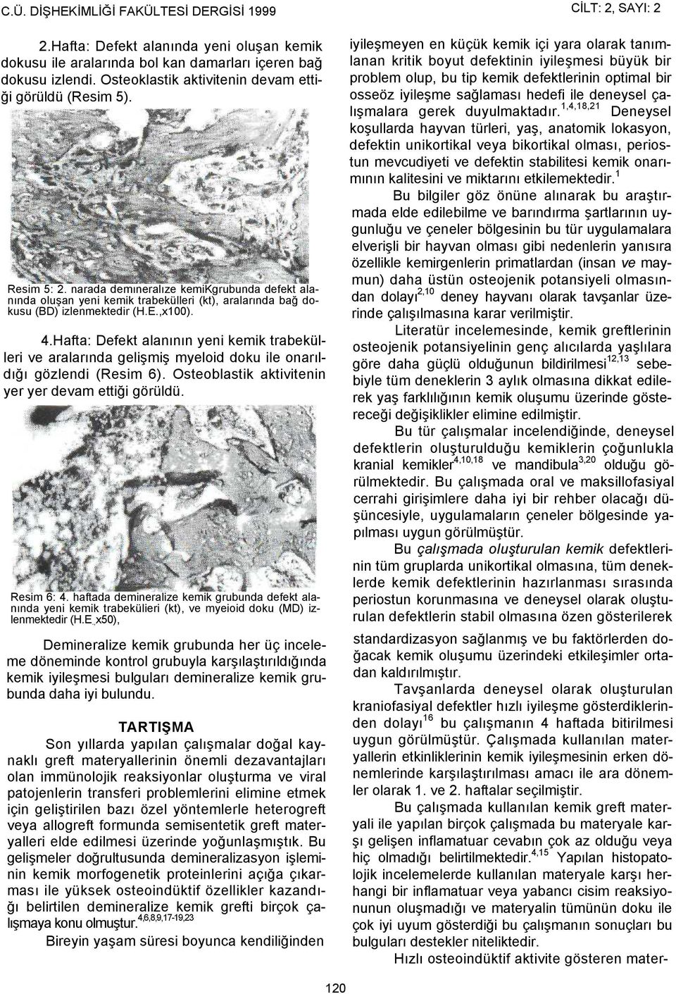 E.,x100). 4.Hafta: Defekt alanının yeni kemik trabekülleri ve aralarında gelişmiş myeloid doku ile onarıldığı gözlendi (Resim 6). Osteoblastik aktivitenin yer yer devam ettiği görüldü. Resim 6: 4.