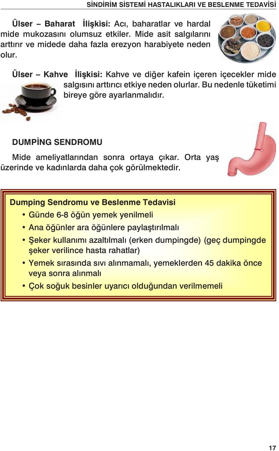 DUMPİNG SENDROMU Mide ameliyatlarından sonra ortaya çıkar. Orta yaş üzerinde ve kadınlarda daha çok görülmektedir.