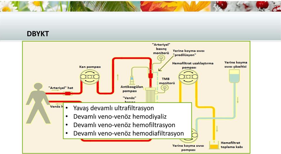 hemodiyaliz Devamlı veno venöz