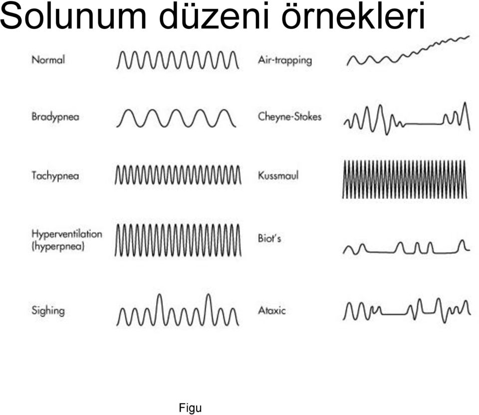 örnekleri