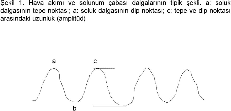 şekli.