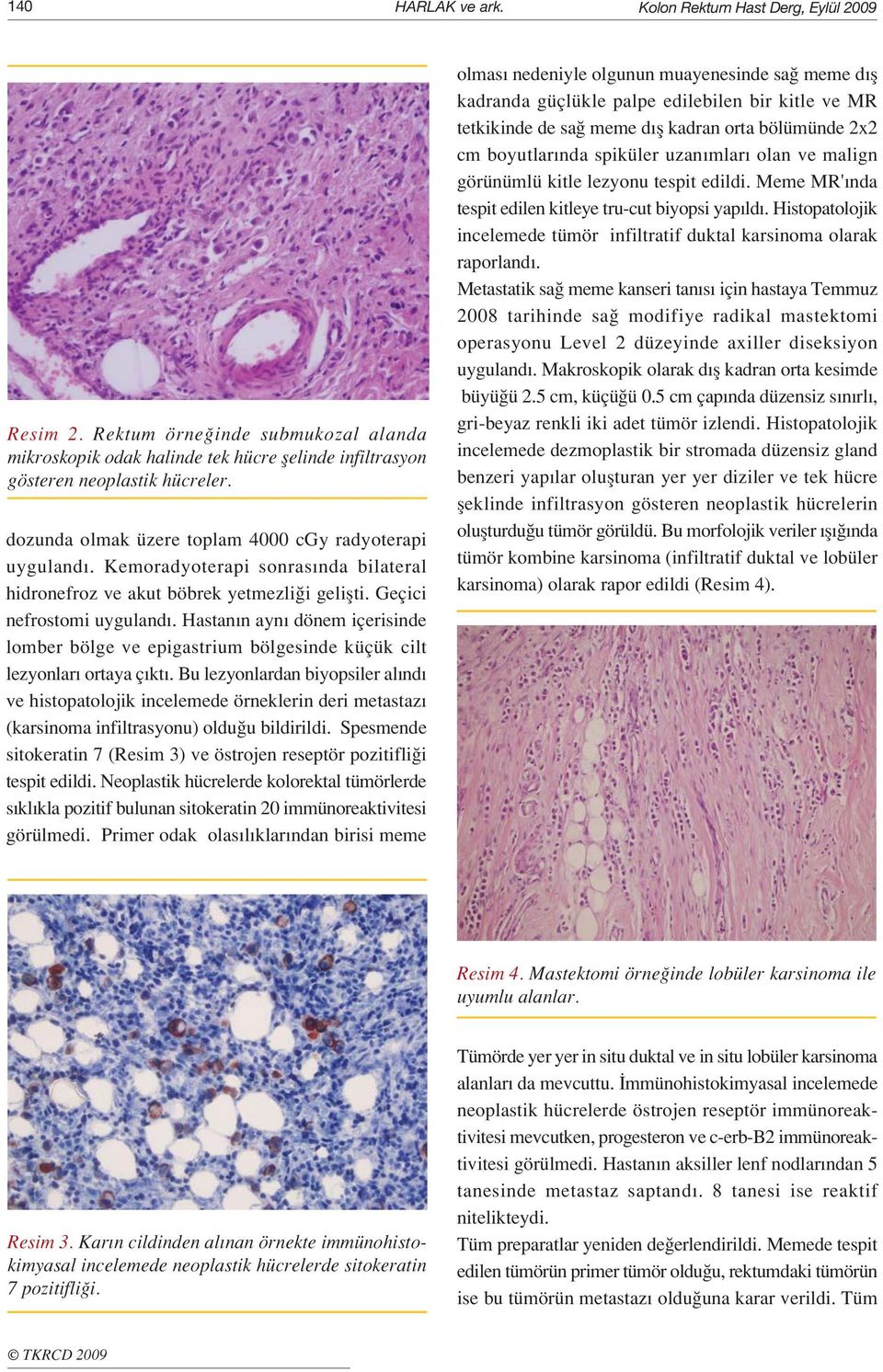 Hastan n ayn dönem içerisinde lomber bölge ve epigastrium bölgesinde küçük cilt lezyonlar ortaya ç kt.