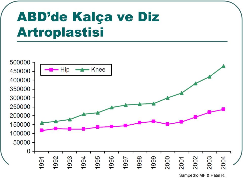 Artroplastisi