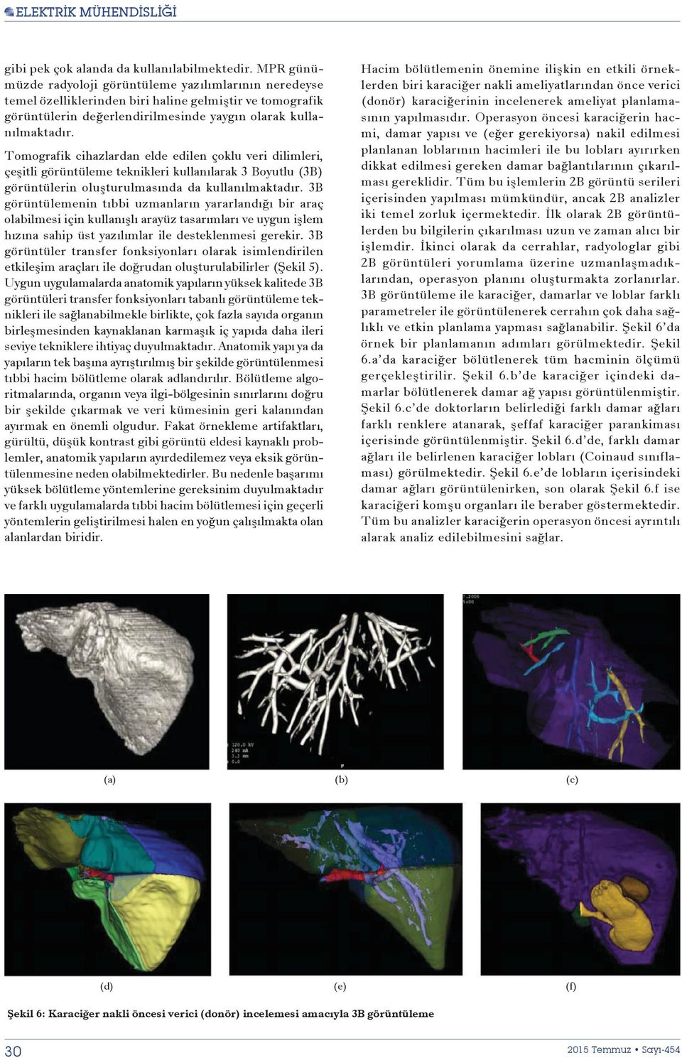 Tomografik cihazlardan elde edilen çoklu veri dilimleri, çe itli görüntüleme teknikleri kullanõlarak 3 Boyutlu (3B) görüntülerin olu turulmasõnda da kullanõlmaktadõr.