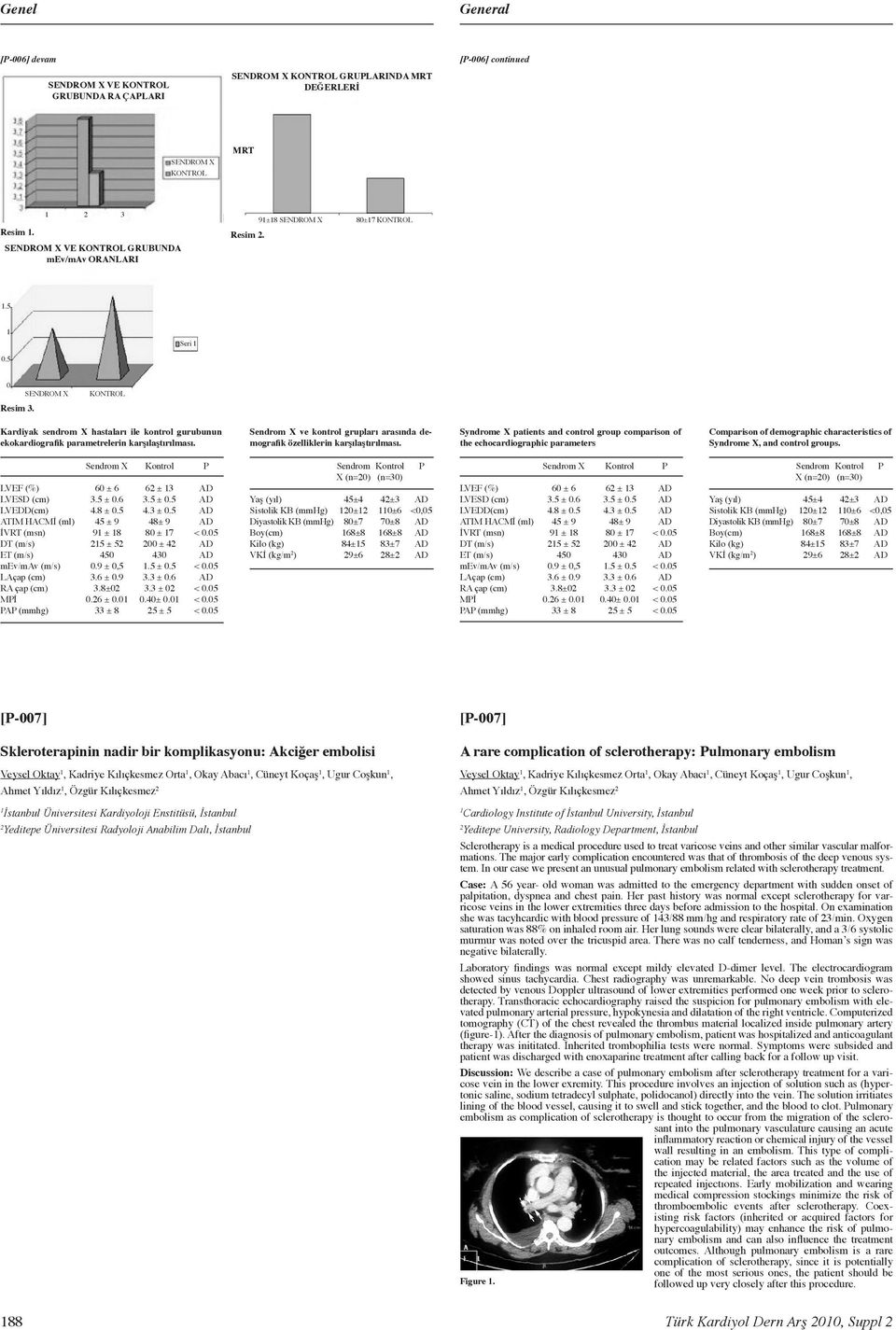 SENDROM X KONTROL Kardiyak sendrom X hastaları ile kontrol gurubunun ekokardiografik parametrelerin karşılaştırılması. Sendrom X ve kontrol grupları arasında demografik özelliklerin karşılaştırılması.