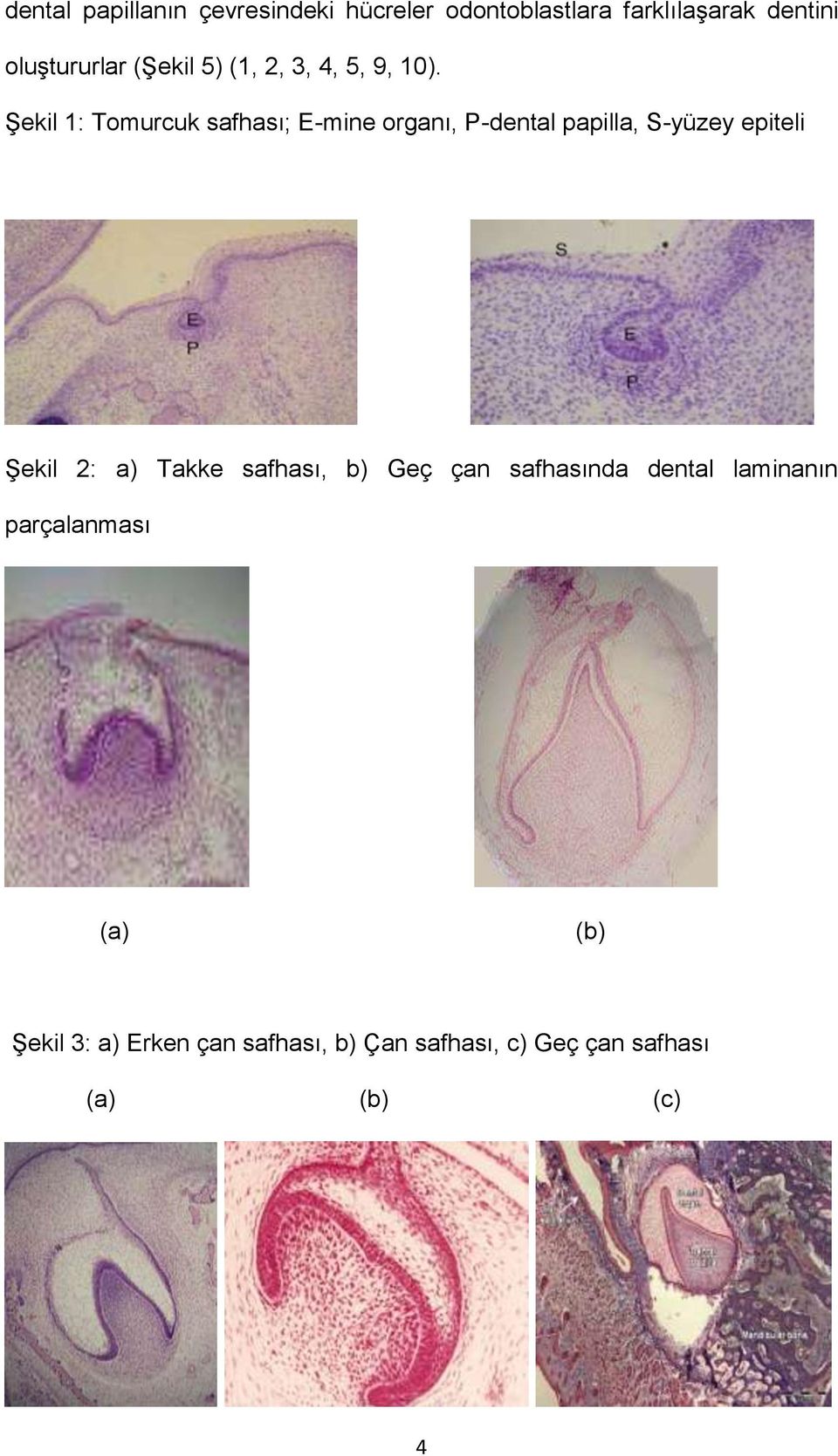 Şekil 1: Tomurcuk safhası; E-mine organı, P-dental papilla, S-yüzey epiteli Şekil 2: a)