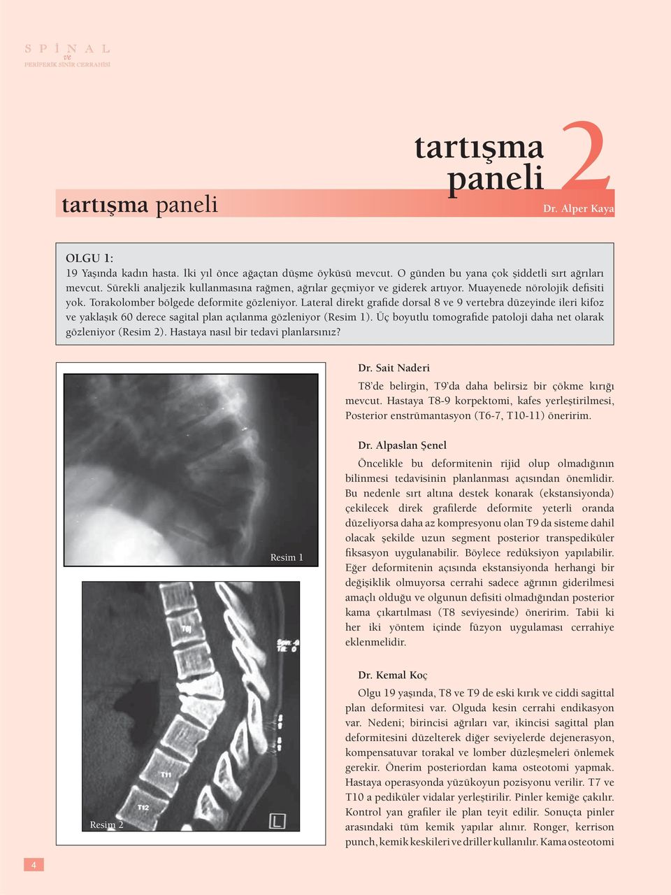 Lateral direkt grafide dorsal 8 ve 9 vertebra düzeyinde ileri kifoz ve yaklaşık 60 derece sagital plan açılanma gözleniyor (Resim 1).