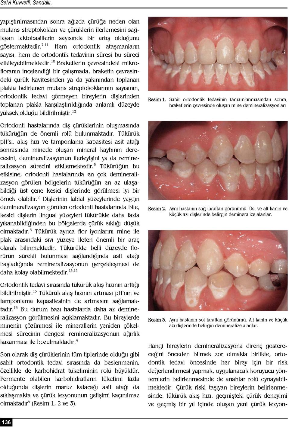 10 Braketlerin çevresindeki mikrofloranın incelendiği bir çalışmada, braketin çevresindeki çürük kavitesinden ya da yakınından toplanan plakta belirlenen mutans streptokoklarının sayısının,