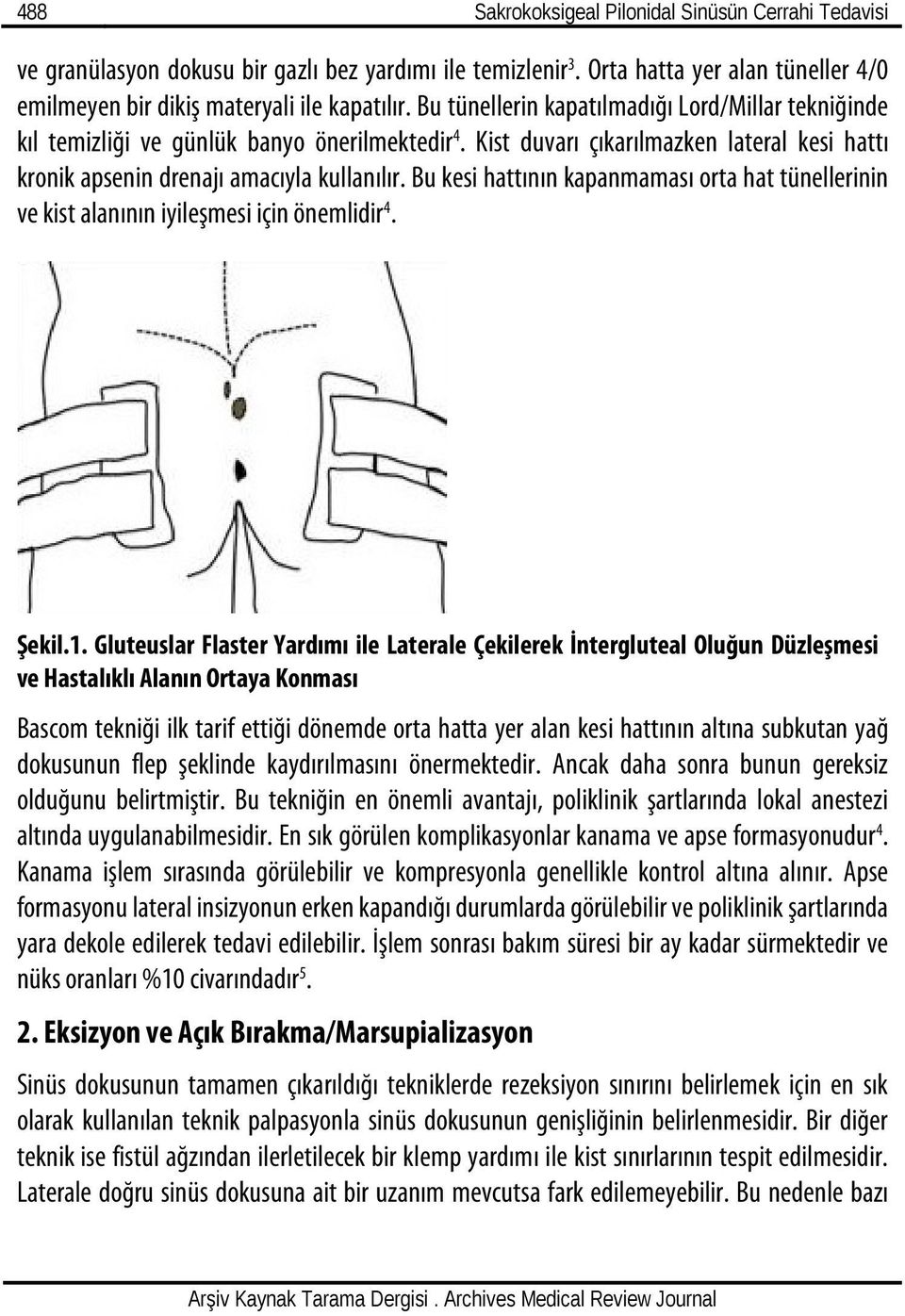 Bu kesi hattının kapanmaması orta hat tünellerinin ve kist alanının iyileşmesi için önemlidir 4. Şekil.1.