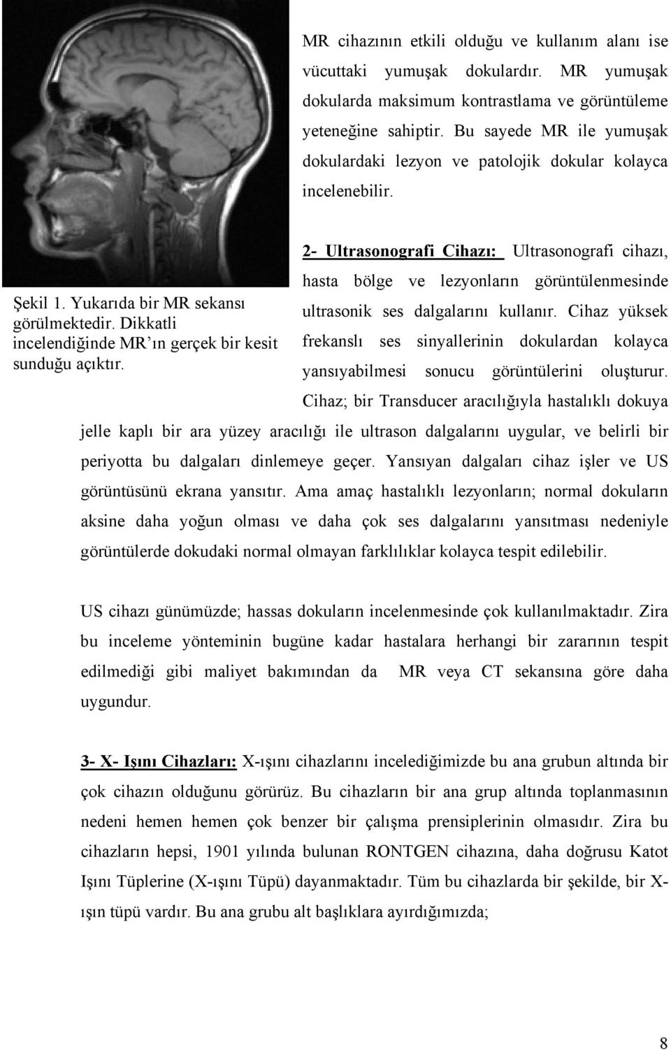 Yukarıda bir MR sekansı ultrasonik ses dalgalarını kullanır. Cihaz yüksek görülmektedir. Dikkatli incelendiğinde MR ın gerçek bir kesit frekanslı ses sinyallerinin dokulardan kolayca sunduğu açıktır.