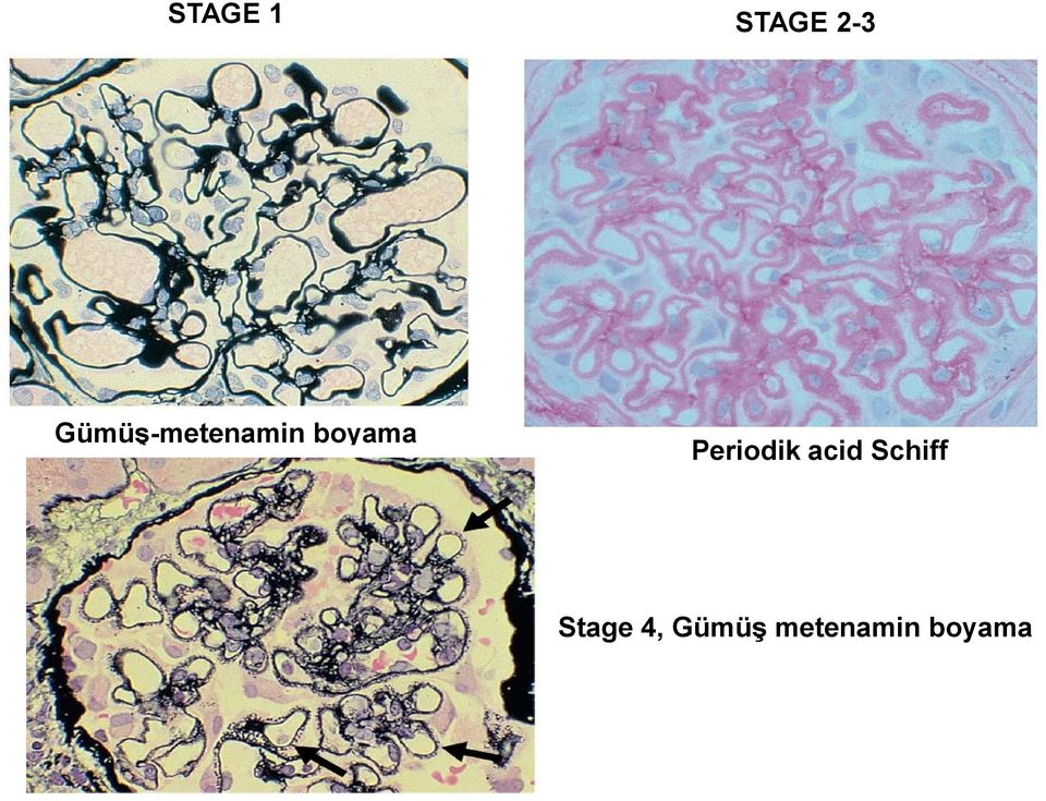 Periodik acid Schiff