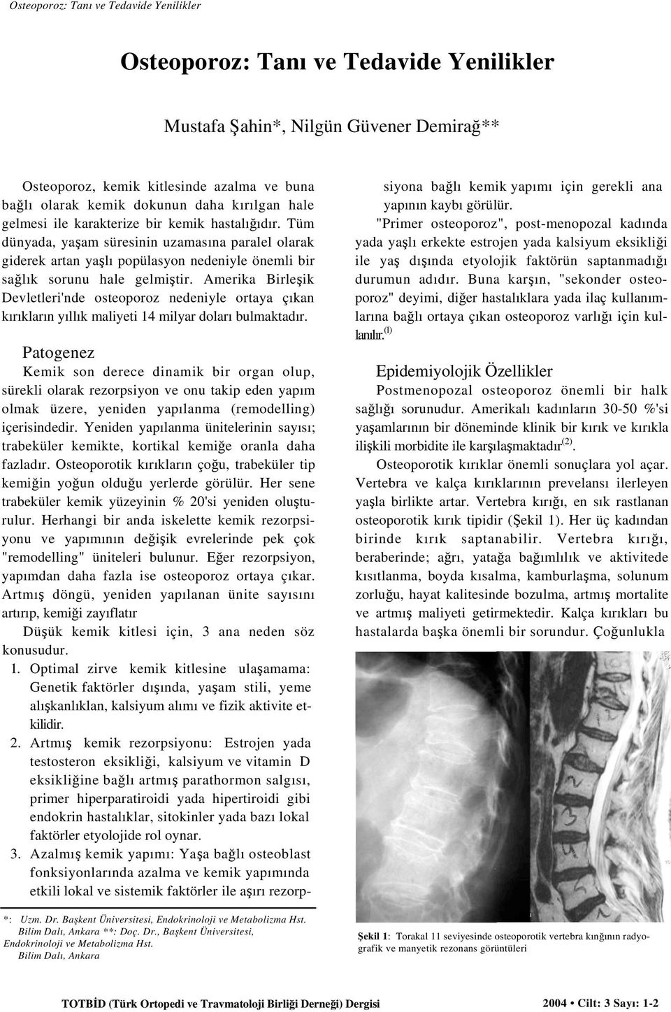 Amerika Birleşik Devletleri'nde osteoporoz nedeniyle ortaya çıkan kırıkların yıllık maliyeti 14 milyar doları bulmaktadır.