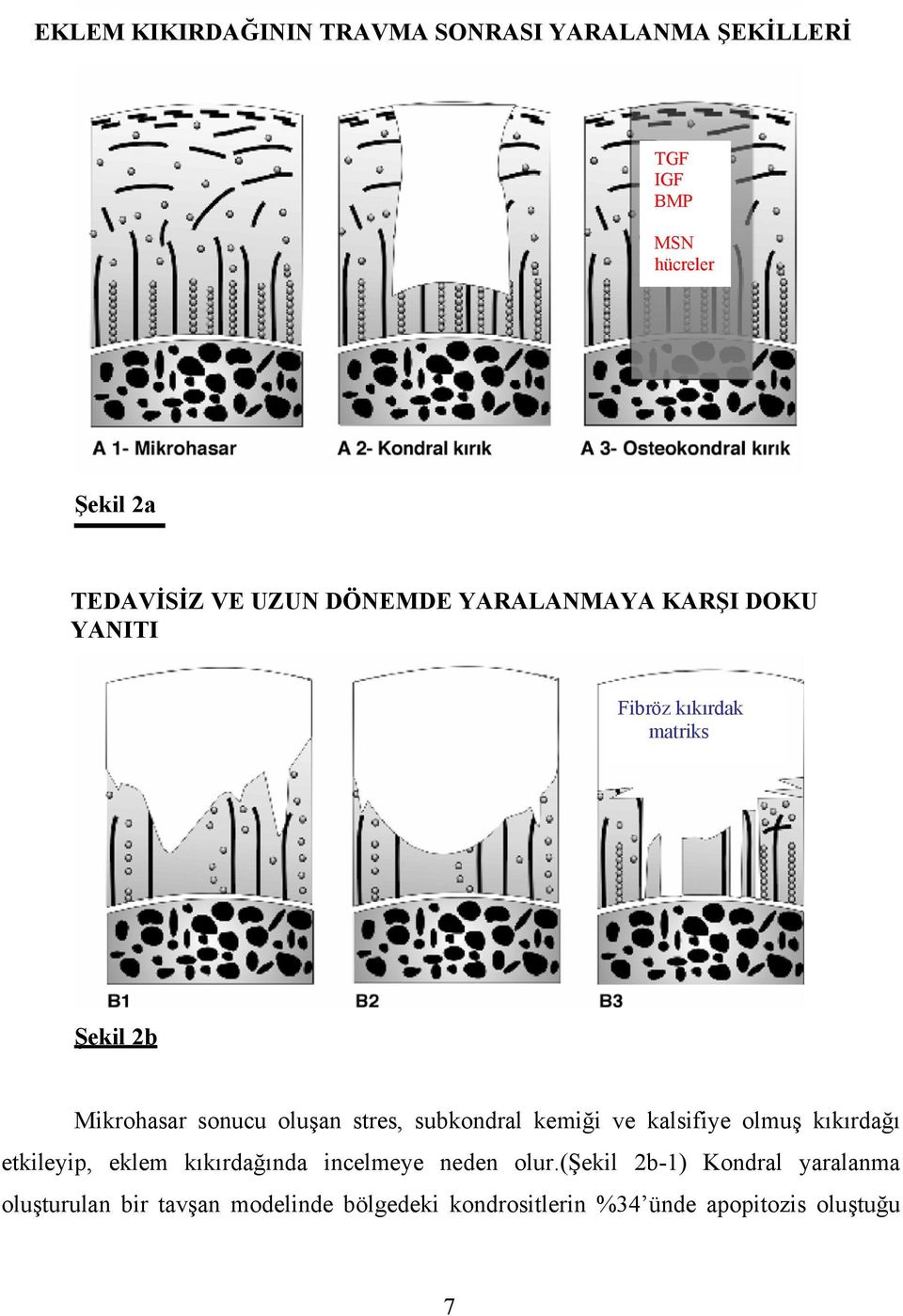 subkondral kemiği ve kalsifiye olmuş kıkırdağı etkileyip, eklem kıkırdağında incelmeye neden olur.