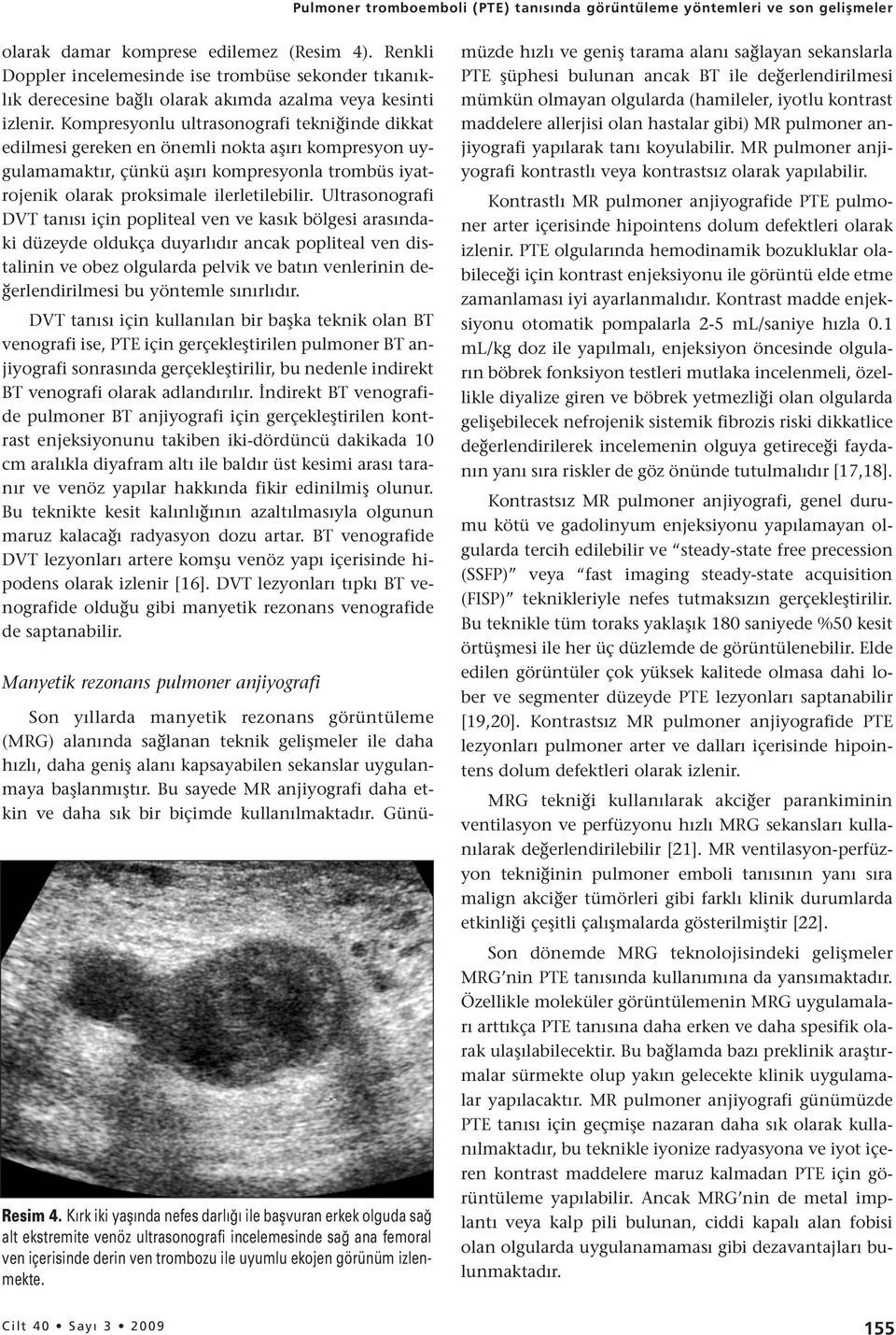 Kompresyonlu ultrasonografi tekniğinde dikkat edilmesi gereken en önemli nokta aşırı kompresyon uygulamamaktır, çünkü aşırı kompresyonla trombüs iyatrojenik olarak proksimale ilerletilebilir.