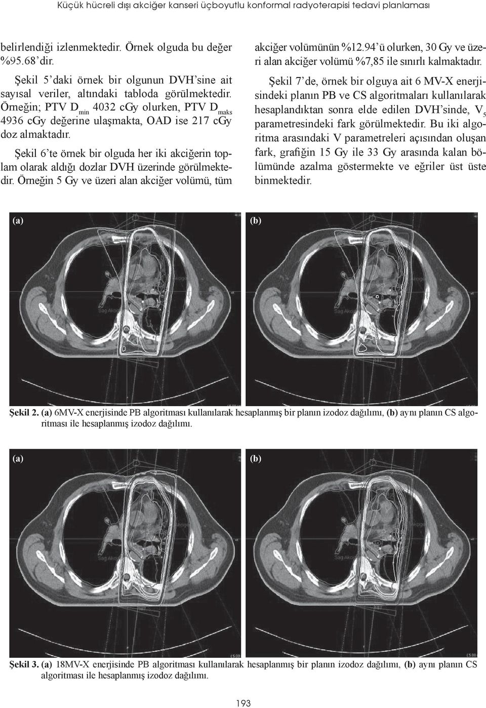 Örneğin; PTV D min 4032 cgy olurken, PTV D maks 4936 cgy değerine ulaşmakta, OAD ise 217 cgy doz almaktadır.