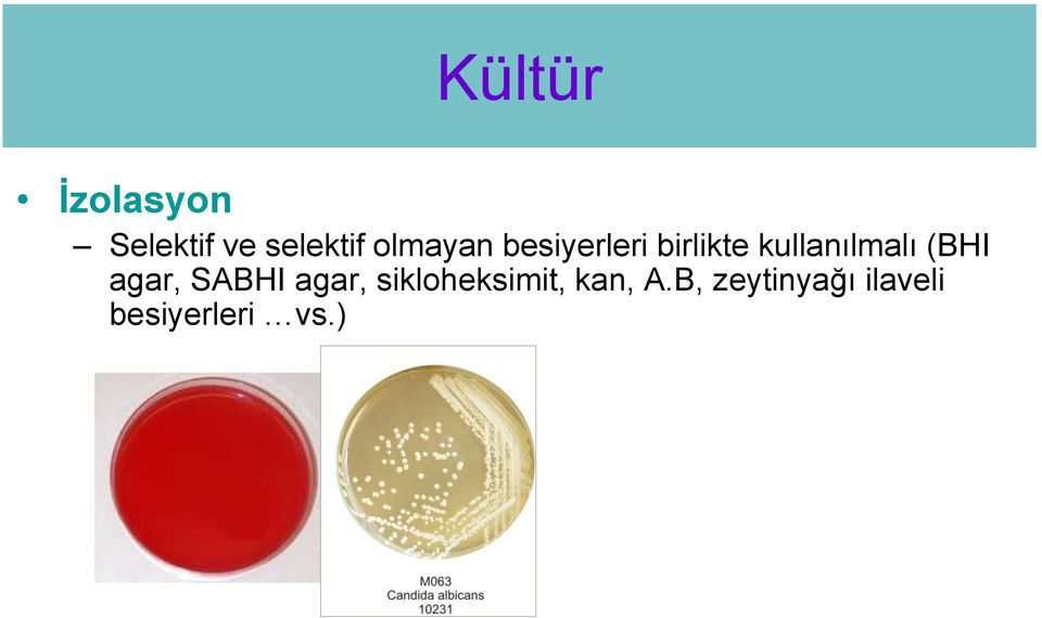 kullanılmalı (BHI agar, SABHI agar,