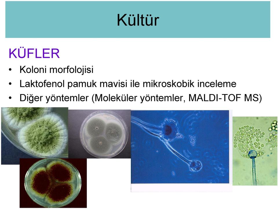 mikroskobik inceleme Diğer