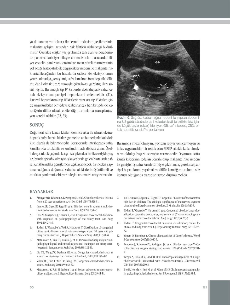 değişiklikler nedeni ile malignite riski artabileceğinden bu hastalarda sadece kist eksizyonunun yeterli olmadığı, genişlemiş safra kanalının intrahepatik bölümü dahil olmak üzere tümüyle çıkarılması