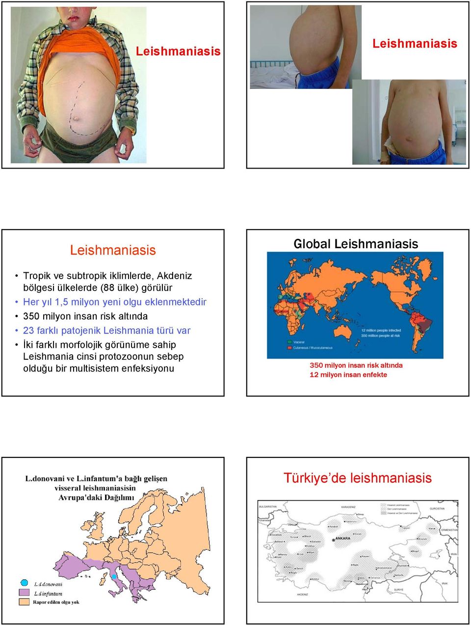 Leishmania türü var İki farklı morfolojik görünüme sahip Leishmania cinsi protozoonun sebep olduğu bir