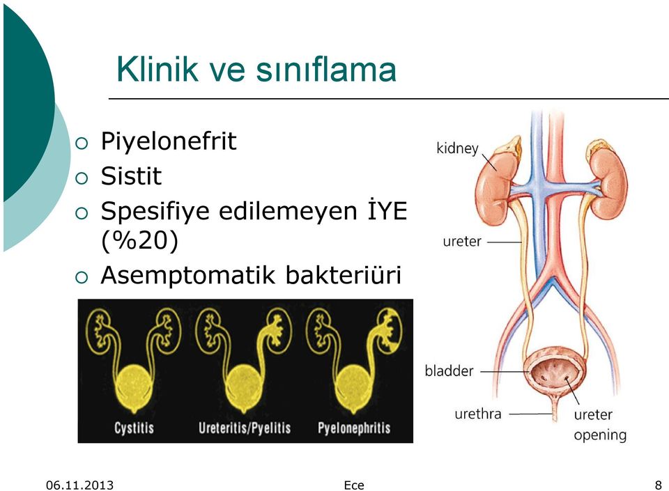 Spesifiye edilemeyen İYE