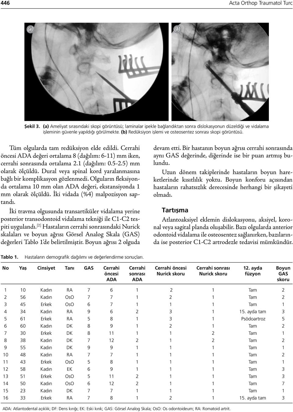 (b) Redüksiyon işlemi ve osteosentez sonrası skopi görüntüsü. Tüm olgularda tam redüksiyon elde edildi. Cerrahi öncesi ADA değeri ortalama 8 (dağılım: 6-11) mm iken, cerrahi sonrasında ortalama 2.