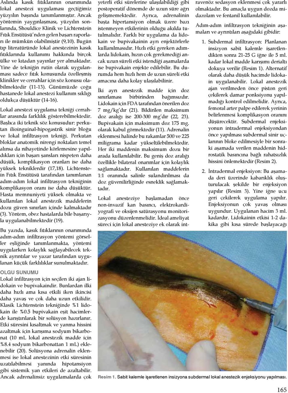 Bugün tıp literatüründe lokal anestezinin kasık fıtıklarında kullanımı hakkında birçok ülke ve kıtadan yayınlar yer almaktadır.