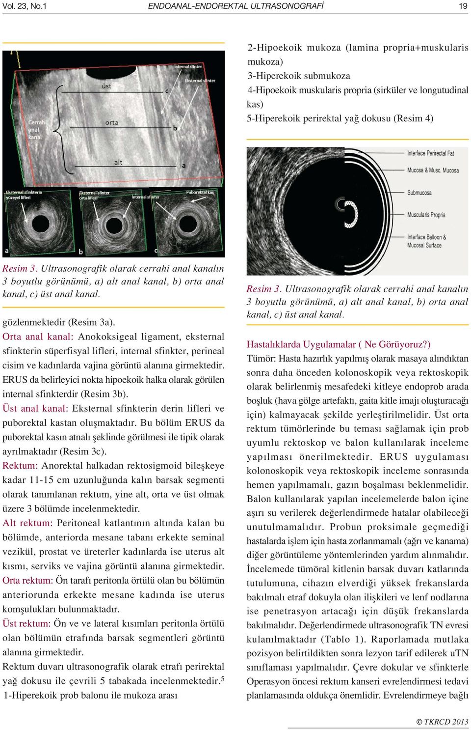 perirektal ya dokusu (Resim 4) Resim 3. Ultrasonografik olarak cerrahi anal kanal n 3 boyutlu görünümü, a) alt anal kanal, b) orta anal kanal, c) üst anal kanal. gözlenmektedir (Resim 3a).